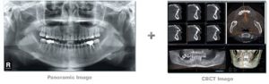 Dental 3D Cone Beam images