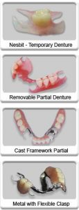 Partial Denture